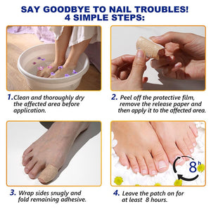 Fungal Nail Patches