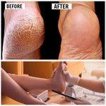 2022 New Pedicure Foot File